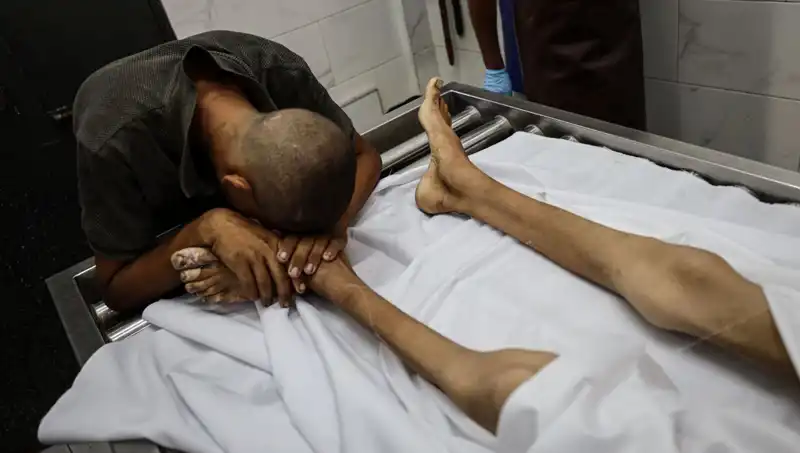 Gazze’deki Çocuklar Kıtlıkla Mücadele Ediyor: Üzücü Bir Kaybın Ardındaki Gerçekler