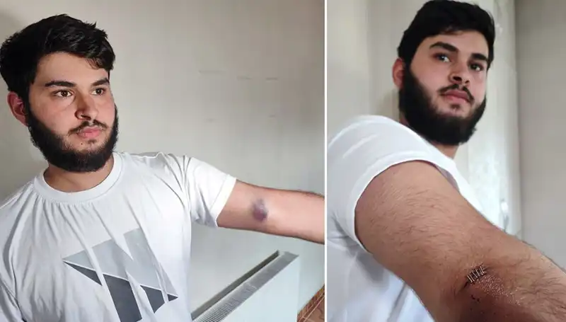 Bahçeye Kaçan Top, Mahalleyi Karıştırdı: Conolar Kamyonetle Geldi!